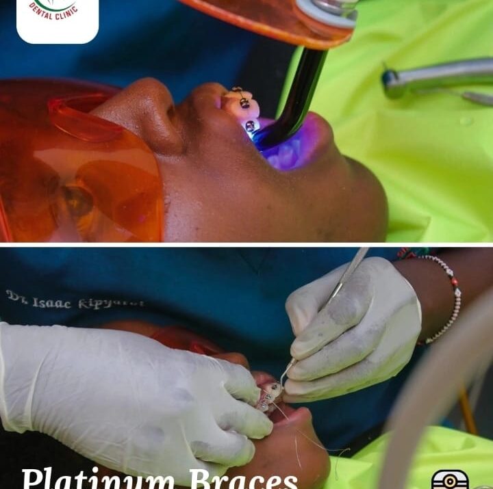 Paediatric Dentist Near Me in Nairobi